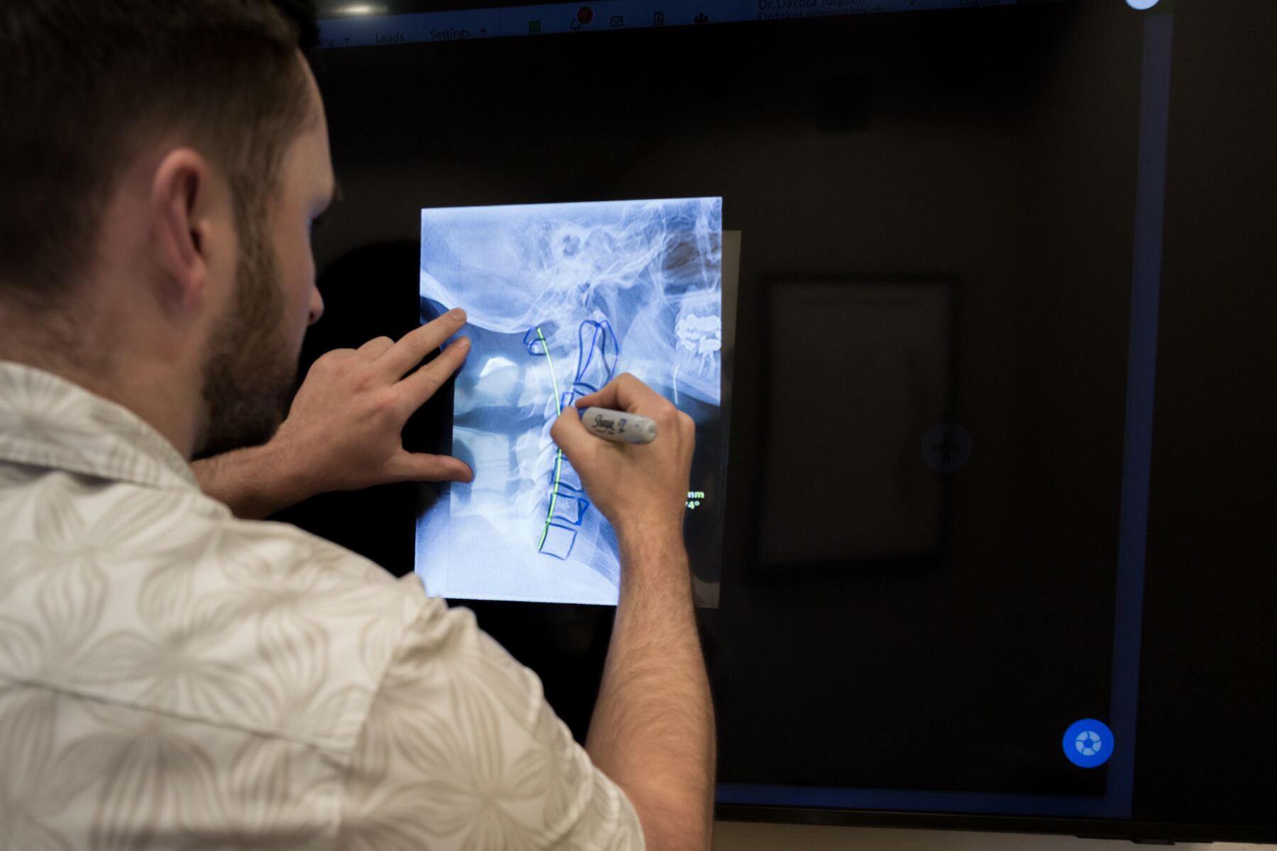 Dr. Dakota reviewing cervical spine imaging