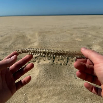 Chiropractic Bellingham WA Spine on the Beach